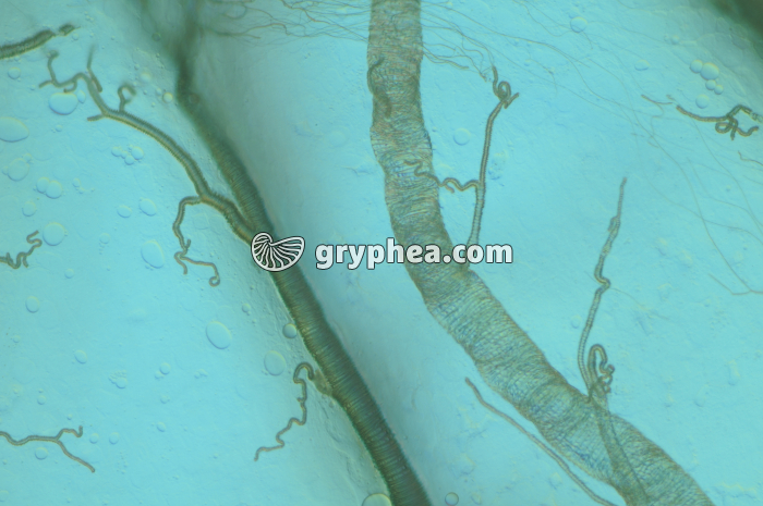 Trachées et trachéoles x100 - gryphea.org